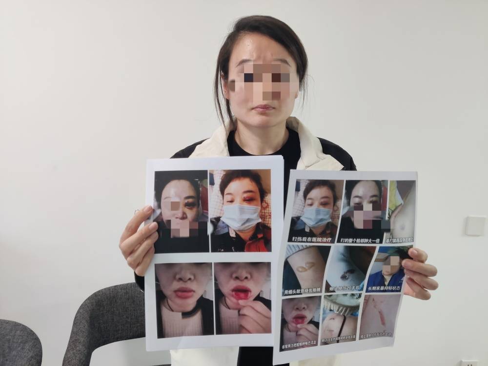 王者荣耀
_郑州一女子被企业家丈夫家暴最新进展：已要回孩子抚养权